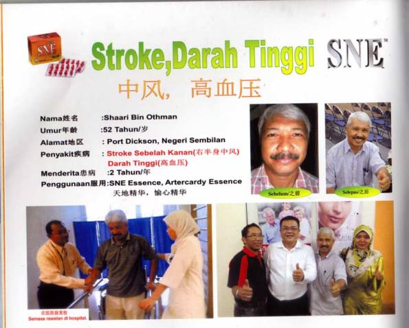 Stroke testimony - Shaari